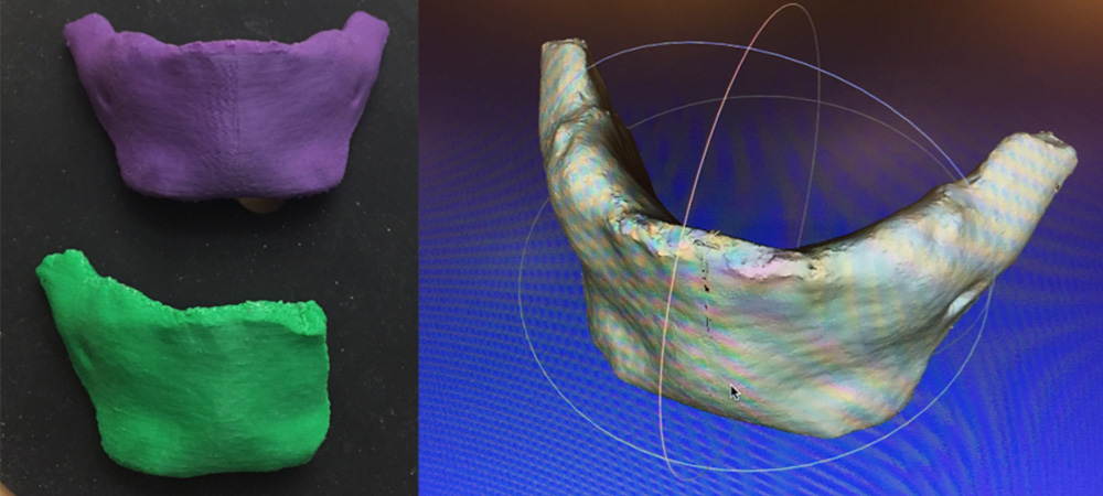 1图像3D打印人族下颌骨，1图像人族下颌骨在3D建模程序